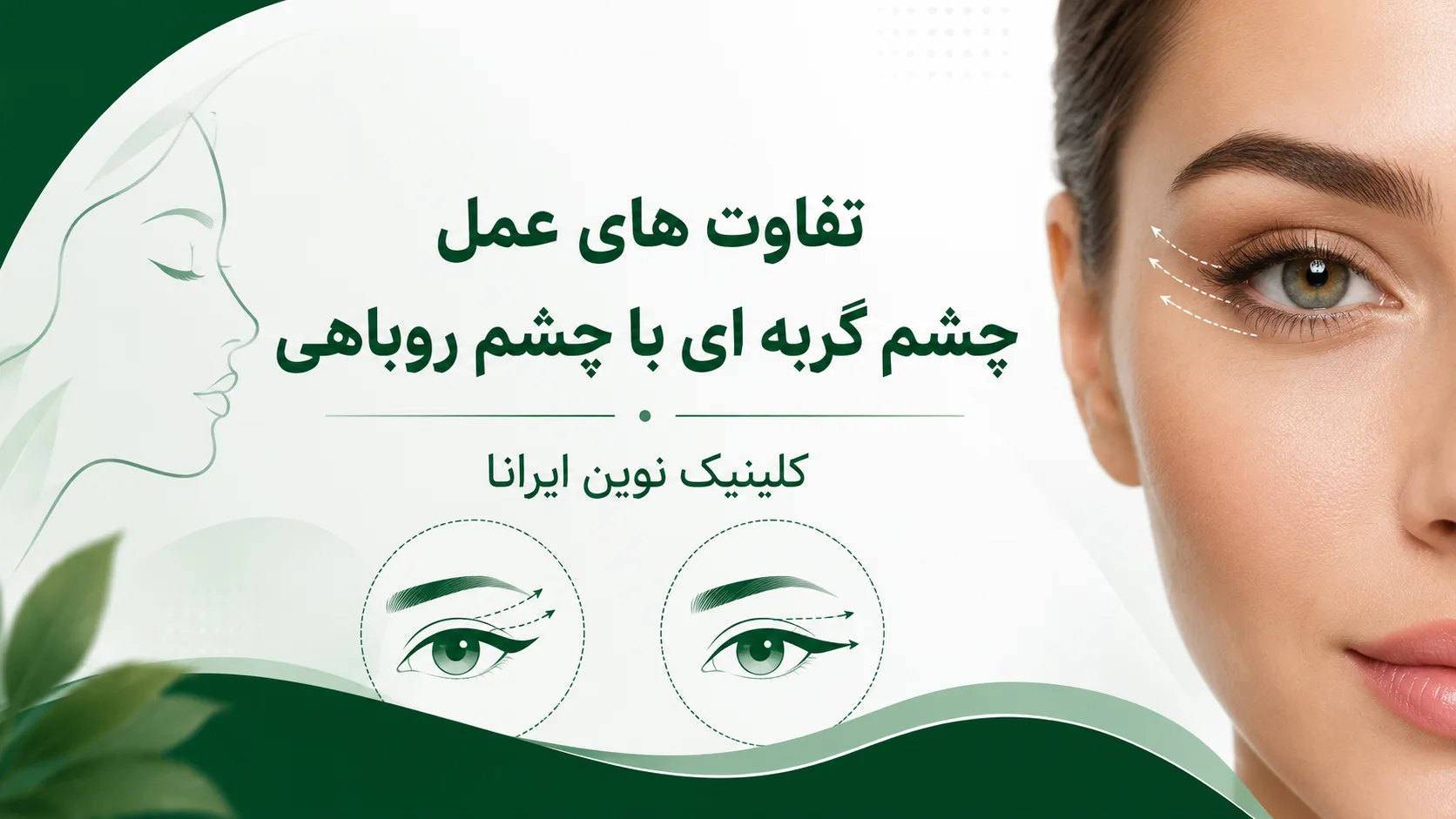 تفاوت های کلیدی بین عمل چشم گربه ای و چشم روباهی